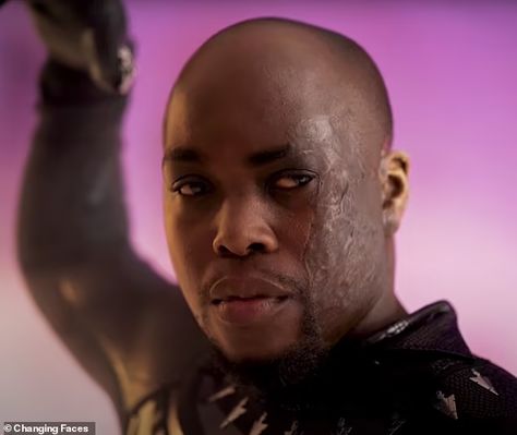 People with facial scars and disfigurements dress up as heroes in charity campaign | Daily Mail Online Facial Scarring, Scarred Face, Charity Campaign, Movie Star Dress, Facial Scars, The Black Panther, The Wizard Of Oz, The Wizard, Indiana Jones