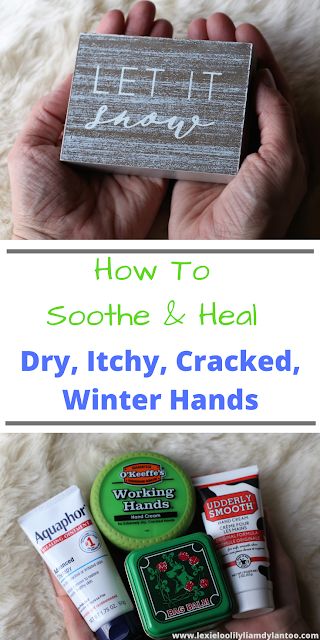 How To Soothe & Heal Dry, Itchy, Cracked, Winter Hands #skincare #dryskin Cracked Finger Tips, Dry Cracked Hands Remedy, Cracked Hands Remedy, Hand Remedies, Cracked Fingertips, Dry Hands Remedy, Dry Patchy Skin, Extremely Dry Hands, Itchy Hands