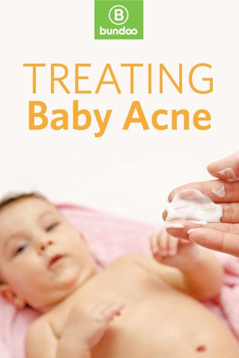 What really works for baby acne? Baby Acne Remedy, Newborn Acne, Acne Remedy, Baby Acne, Baby Guide, Baby Ruth, Super Healthy Kids, Newborn Photo Shoot, Baby Driver