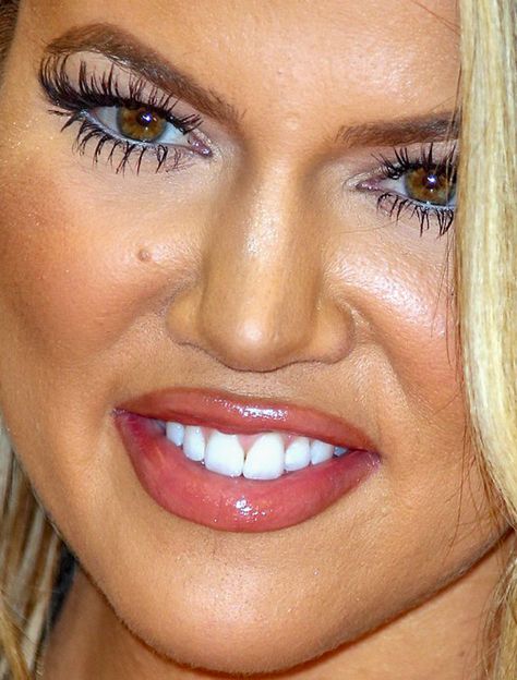 Khloe Kardashian Red Carpet, Kardashian Lips, Kardashian Red Carpet, Nose Jobs, Bad Skin, Red Carpet Makeup, Tear Trough, Bad Makeup, Bad Teeth