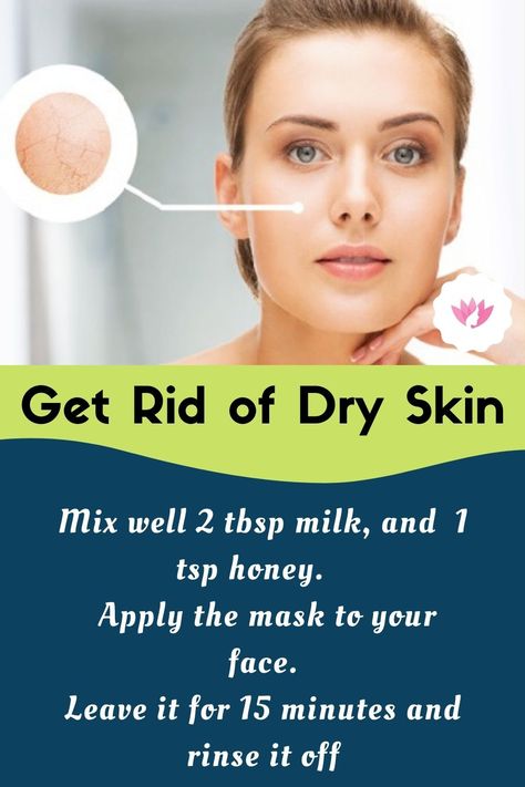 Best Face Masks For Dry Skin, Dry Face Remedy, Dry Skin Remedies For Face, Dry Skin Face Mask, Get Rid Of Dry Skin, Dry Skin Diy, Living Naturally, Messi Wallpapers, Natural Cleansing