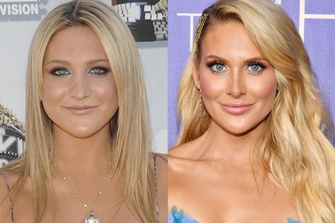 The Hills Cast Before And After Beauty Transformations | BEAUTY/crew Heidi Montag Before And After, Semiglude Before And After, Audrina Patridge The Hills, 00s Trends, The Hills Cast, Stephanie Pratt, Audrina Patridge, Iconic Beauty, Kristin Cavallari