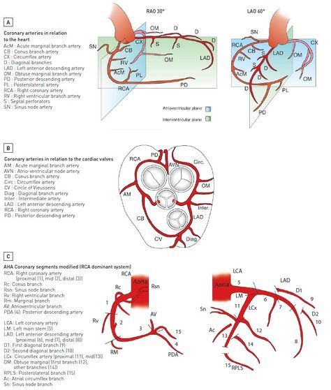 Percutaneous interventional cardiovascular medicine - Invasive diagnostic coronary angiography Coronary Arteries Anatomy, Surgery Motivation, Coronary Angiography, Cath Lab Nursing, Cardiac Cath, Cardiac Anatomy, Arteries Anatomy, Cardiac Sonography, Interventional Cardiology