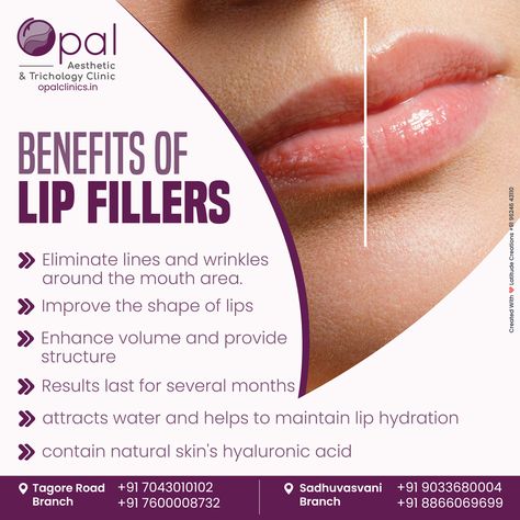 💋 Unlock the beauty benefits of lip fillers with Opal Clinic! ✨ Ready to experience these amazing benefits? Consult with the Opal Clinic and let your lips do the talking! 💄💋 Opal Clinic Rajkot, Gujarat #LipFillers #Fillers #Lips #OpalClinic #BeautyCare #Dermatology #SkinCare #LipsCare #FillersforLips #YouthfulLips #BenefitsofLipFillers Beauty Parlour, Hair Clinic, Beauty Parlor, Lip Hydration, Lip Fillers, Skin Care Solutions, Your Lips, Creative Ads, Dermatology