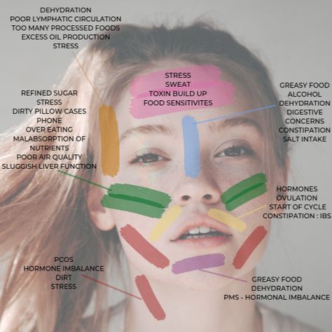 Most Common Non-Hormonal Acne Triggers Breakout Map, Acne Triggers, How To Hide Pimples, Hormonal Acne Diet, Skin Breaking Out, Acne Diet, Healthy Fiber, Hormonal Acne, Acne Breakout