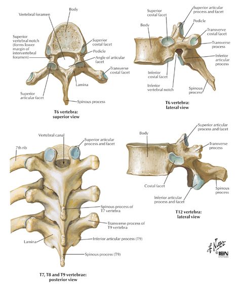 Spine & Back:Bones:Thoracic vertebrae | RANZCRPart1 Wiki | FANDOM powered by Wikia Typical Vertebra Anatomy, Cervical Vertebrae Anatomy, Spine Pictures, Human Vertebrae, Spine Anatomy, Axial Skeleton, Thoracic Vertebrae, Anatomy Bones, Skeleton Anatomy