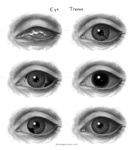 "Eyes" illustrations by DeviantArt user "God-Head" #eyes #illustration #reference #drawing Drawing Blind Eyes, Possessed Eyes Drawing, Blind Eyes Drawing Reference, Blind Eyes Art, How To Draw Blind Eyes, High Eyes Drawing, Scars Reference Drawing, Mad Eyes Drawing, Blind Eyes Drawing