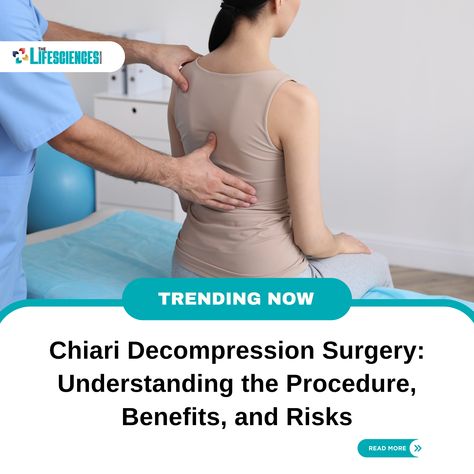 Chiari Decompression Surgery: Understanding the Procedure, Benefits, and Risks

Chiari malformation occurs when the lower part of the cerebellum extends into the spinal canal. This can obstruct the flow of cerebrospinal fluid (CSF)

🔶Symptoms:
🔷Severe headaches
🔷Neck pain
🔷Unsteady gait (problems with balance)
🔷Poor hand coordination (fine motor skills)
🔷Numbness and tingling of the hands and feet
🔷Dizziness
🔷Difficulty swallowing Chiari Malformation, Cerebrospinal Fluid, Severe Headache, Neck Pain, Fine Motor Skills, Headache, Fine Motor, Motor Skills, Surgery