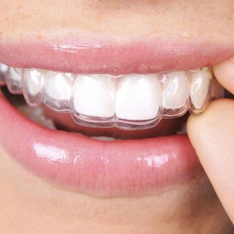 Transparent Braces, Teeth Remedies, Invisible Braces, Dental Photography, Clear Braces, Loose Tooth, Teeth Straightening, Teeth Braces, Dental Center