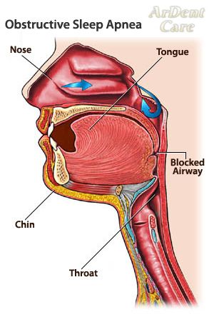 Sleep apnea? We can help! Call 412-795-5050 today Respiratory System Anatomy, Anatomy Head, Best Fat Burning Workout, Soft Palate, Animal Adaptations, Fat Burning Diet, Fat Burning Supplements, Human Anatomy Drawing, Diagram Design