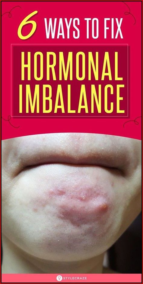 Fix Hormonal Imbalance, Low Estrogen Symptoms, Too Much Estrogen, Low Estrogen, Womens Health Care, Hormonal Imbalance, Women Health Care, Natural Health Tips, Hormone Levels