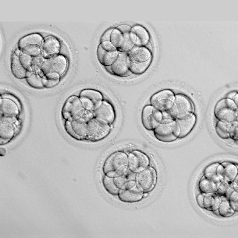 There are five options for IVF patients to consider when it comes to their remaining frozen embryos. Learn more here. Invitro Fertilization, Pregnancy Workout Videos, Embryo Adoption, Ivf Pregnancy, Chances Of Pregnancy, Ivf Cycle, Ivf Success, Parenting Techniques, Lds Church