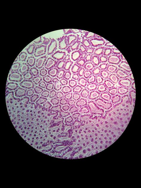 Simple epithelial cell of kidney. Tubule under microscope , #Affiliate, #cell, #epithelial, #Simple, #microscope, #Tubule #ad Microscopic Cells Art, Cell Microscope Art, Human Cells Under Microscope, Microscopic Cells Biology Art, Cells Through Microscope, Cells Aesthetic Biology, Human Cells Microscope, Cells Under Microscope Art, Under The Microscope Art