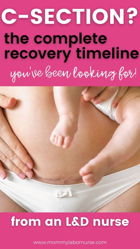 C Section Recovery Timeline, C Section Scars, C Section Recovery, Cesarean Section, After Birth, C Section, Star Nursery, Postpartum Recovery, Pregnancy Tips