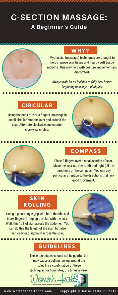 Scar Massage, C Section Scars, Cold Sores Remedies, Natural Sleep Remedies, Natural Cold Remedies, Cough Remedies, Cold Sore, Scar Tissue, C Section