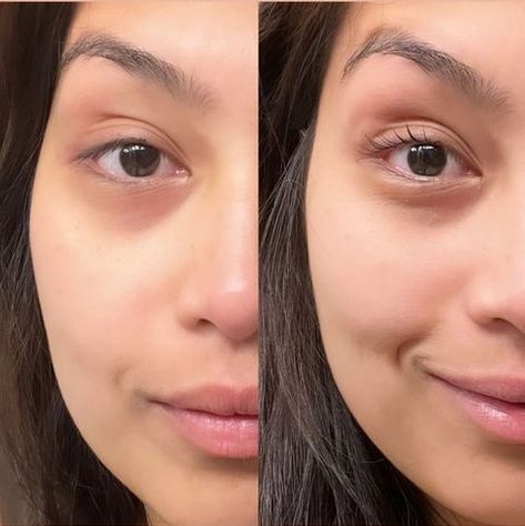 From 👁 ⬇️ To 👁 ⬆️ Sometimes your lashes aren't short, they just need a little lift in life 💖 @dianeheld.makeup #diablocosmetics #diabloolashlift #diablolashserum #diabloeyelashserum #lashlooks #lashstyle #browlovers #beautylovers #lashtips #athomebeauty #beautycommunity #beautytips #beautyproducts #browhacks #lashahcks Natural Lash Lift Diy, Eyelash And Eyebrow Lift, Lash Lift Short Lashes, Lash Lift Amazon, Lash Lift Elleebana, Brow Hacks, Short Lashes, Eyelash Serum, Lash Serum