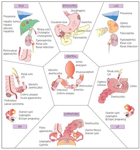 GI Assessment Gi System Nursing, Gastrointestinal Nursing, Nursing Apps, Pass Nursing School, Medications Nursing, Nursing Cheat, Nursing Board, Med Surg Nursing, Nursing School Essential