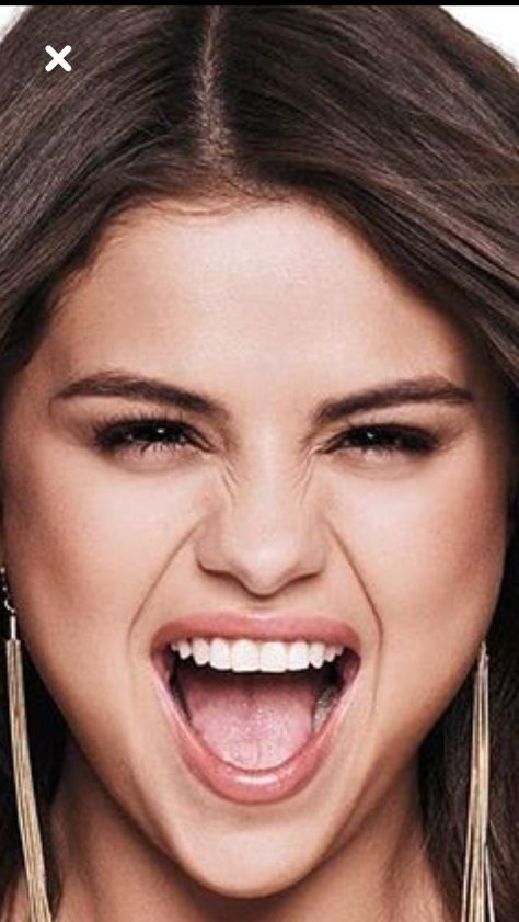 Selena Gomez Teeth, Perfect Smile, Selena Gomez