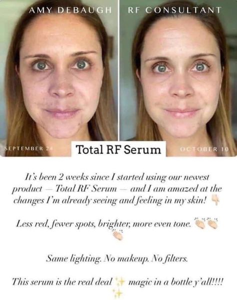 Total Rf Serum, Active Hydration Serum, Makeup Things, Rodan And Fields Consultant, Hydration Serum, Popsugar Beauty, Enlarged Pores, No Makeup, Anti Aging Serum