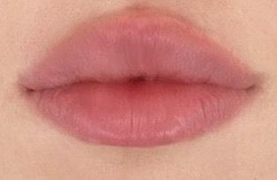 Non Cupids Bow Lips, Lips No Cupid, Round Lip Filler Shape, Round Cupids Bow Lips Aesthetic, Lip Claims For Dr, Round Lips Aesthetic, Round Top Lip, Heavy Upper Lip, Round Cupids Bow Lips