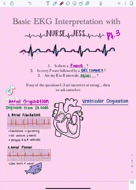 Part 3 | 🫀Basic EKG Interpretation Part 3: Identifying commonly tested Atrial Dysrhythmias 🫀 by: @NurseJess1620 #fbreels #fbreelsvideo #fyp #nursingschool #NCLEX #registerednurse #reels #nclexprep #BSN #nurse #nursingstudent #studentnurse #rn | Flo Nurse Nightingale | Flo Nurse Nightingale · Original audio Ekg Interpretation, Medical Assisting, P Wave, Nclex Prep, Atrial Fibrillation, Nclex, Registered Nurse, Pharmacology, Nightingale