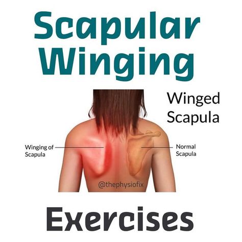 Dr. Stacie | Physical Therapist + Strength Coach on Instagram: "🦅 Scapular Winging 🦅 🔥First off, scapular winging is normal, extremely normal, and usually it’s not something that needs to be addressed ...that is, unless the person is having pain or other impairments due to the winging, or if there is damage to the long thoracic nerve. 🚩The scapula is controlled by 3 main muscles: upper trap, lower trap and serratus anterior, & all of these work together to help rotate the scapula upwards whe Scapula Pain, Scapular Winging, Winged Scapula, Shoulder Impingement, Causes Of Back Pain, Middle Back Pain, Back Stretches For Pain, Back Pain Remedies, Shoulder Injuries