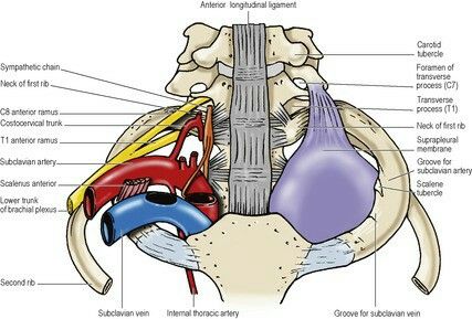 Anatomy Spine, Medical Imaging, Med Student, Med School, Anatomy And Physiology, Origami Art, Medical Students, Radiology, Nerve