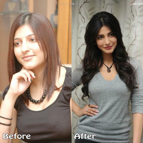 Top Bollywood Plastic Surgery Before After Shruti Hassan Nose Job Lip Botox Pictures Botox Pictures, Lip Plastic Surgery, Face Surgery, Botox Alternative, Nose Surgery, Beauty Makeover, Shruti Hassan, Celebrity Plastic Surgery, Actress Without Makeup