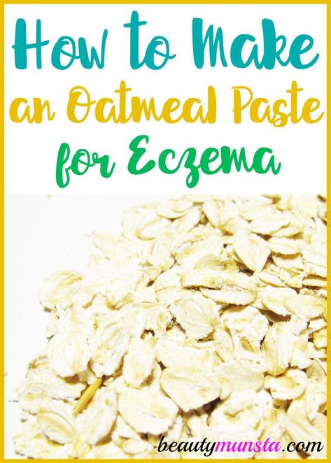 Oatmeal Paste For Itchy Skin, Growing Grape Vines, Recondition Batteries, Natural Beauty Hacks, Natural Health Care, Skin Remedies, Natural Beauty Tips, Foods To Avoid, Natural Remedy