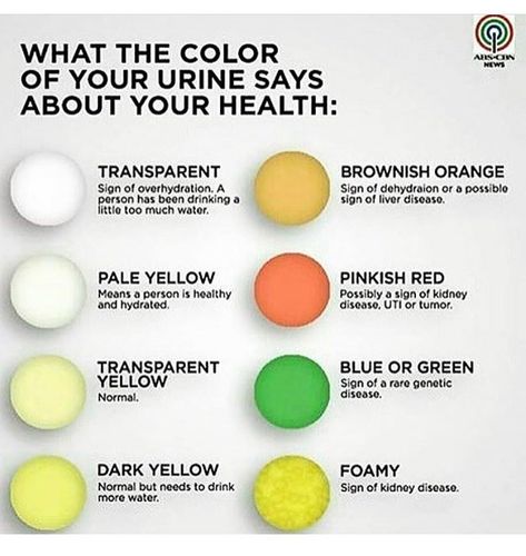 Which one are you???👀 I'm between pale & transparent yellow 💪🏽👏🏽✔️💦👌🏽🔃 #DRINKMOREH20 Green Urine, Pee Color, Color Of Urine, Urine Color, Medical Facts, Nursing School Tips, Nursing School Notes, Medical Anatomy, Medical Studies