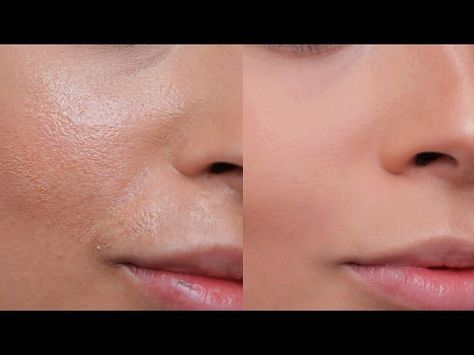 How to Avoid Cakey Foundation & Stop Concealer Creasing | AMANDA ENSING - YouTube Concealer Creasing, Makeup Tutorial Foundation Flawless Face, Contour For Dark Skin, Amanda Ensing, Eyeliner Tips, Best Makeup Tutorials, Makeup Tutorial Foundation, Make Up Tutorials, Face Acne