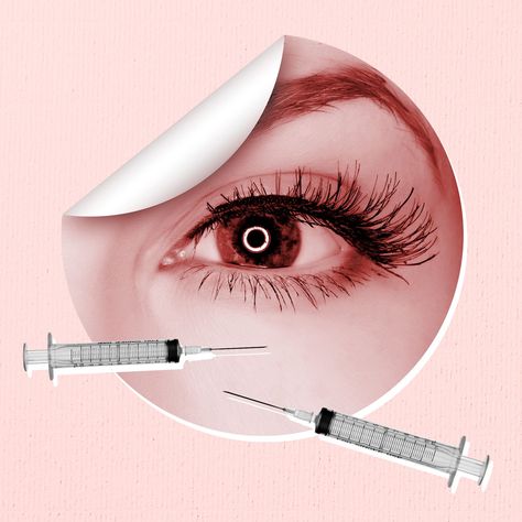 Yes, You Can Get Filler for Your Under Eye Area—But Do You Need It? - TownandCountrymag.com Botox Under Eyes, Under Eye Filler, Eye Filler, Filler Aesthetic, Botox Brow Lift, Under Eye Fillers, Botox Before And After, Botox Lips, Beauty Skin Quotes