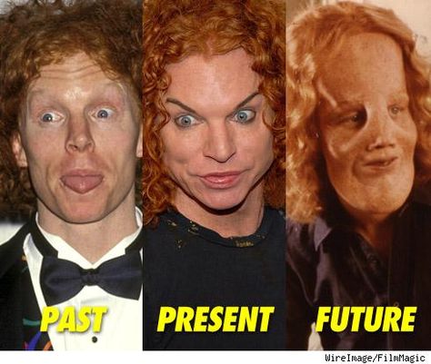 Carrot Top's Evolution Ginger Humor, Surgery Humor, Bad Plastic Surgeries, Plastic Surgery Gone Wrong, Carrot Top, Celebrity Plastic Surgery, Learning To Drive, Past Present Future, Cosmetic Surgery