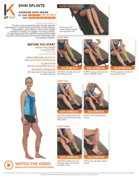 Kt Tape Shin Splints, Shin Splints Taping, Shin Splint Exercises, K Tape, Kt Tape, Kinesio Taping, Kinesiology Taping, Poor Circulation, Shin Splints