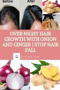 Long Hair Growing Tips, Overnight Hair Growth, Diy Facials, Overnight Hair, How To Grow Hair, Hair Growth Tonic, Hair Repair Treatments, Extreme Hair Growth, Hair Growth Secrets