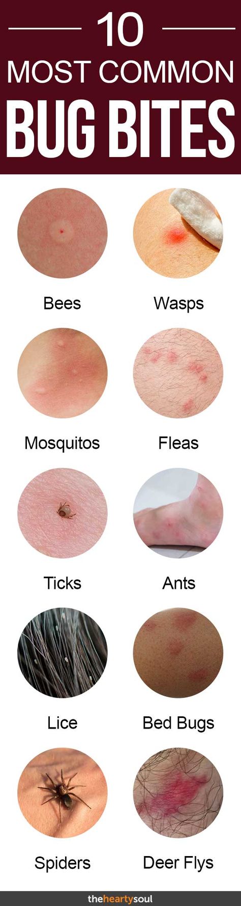 Identify the 10 Most Common Bug Bites in North America and How to Avoid Them | The Hearty Soul Bug Bites Identifying, Types Of Bug Bites, Nature Knowledge, Bug Facts, Homesteading Animals, Wasp Stings, Types Of Bugs, Healthy Advice, Bug Bites