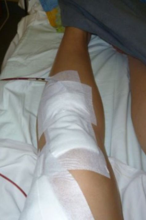 Knee Injury Snapchat, Leg Bandage Snapchat, Tablet Medicine Snap, Fake Injury, Hospital Admit Hand Pics, Breakup Picture, Leg Injury, Bra Image, Video Call With Boyfriend Screen Photo