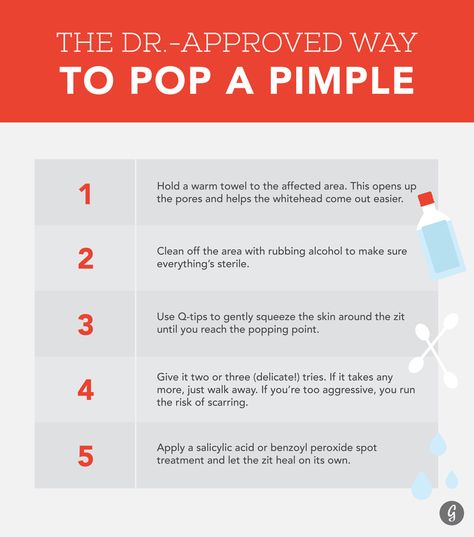 Pimples On Buttocks, Popping Pimples, Pimple Extraction, Blind Pimple, Forehead Acne, Pimples Under The Skin, Skincare Acne, Pimples Remedies, How To Get Rid Of Acne