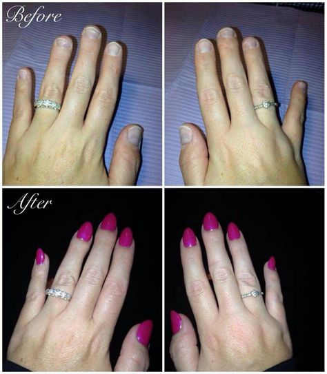 My real nails (wide bitten short nails) .vs. when i make my own using tips and resin-powder method. The shape, almond, is definitely the most flattering one for me. My fingers look way more elongated! Short Fingers, Real Nails, Wide Nails, More Feminine, Nail Biting, Luxury Beauty, Almond Nails, How To Do Nails, Short Nails