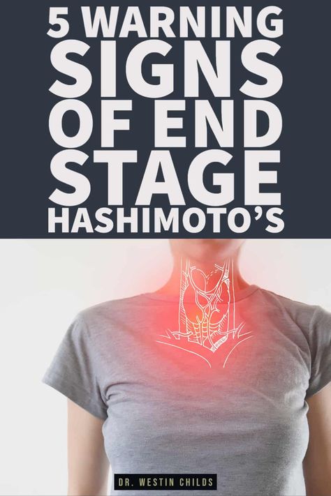 signs of thyroid gland atrophy and end stage hashimoto's Hashimotos Symptoms, Low Thyroid Remedies, Thyroid Remedies, Low Thyroid, Thyroid Symptoms, Hashimotos Disease, Thyroid Medication, Acne Treatments, Thyroid Issues