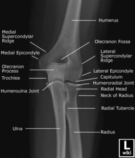 Anatomi Dan Fisiologi, Radiology Schools, Radiologic Technology, Radiology Student, Radiology Technician, Radiology Imaging, Radiology Technologist, Diagnostic Imaging, Lower Limb