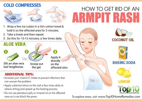 Go to the full website for lots of tips, not just this graphic. Armpit Rash, Skin Care Routine 40s, Forehead Acne, Natural Acne, Natural Acne Remedies, Hormonal Acne, Cystic Acne, Acne Remedies, Skin Remedies