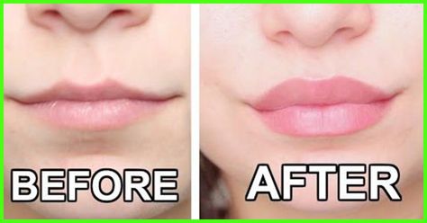 Here are 17 most popular lip plumping product reviews. These lip plumpers help to achieve plumpy lips by increasing blood circulation in the lip area. Get Bigger Lips, Make Lips Bigger, Bigger Lips Naturally, Bigger Lips, Fuller Lips Naturally, Natural Lip Plumper, Large Lips, How To Get Bigger, Makeup Lips