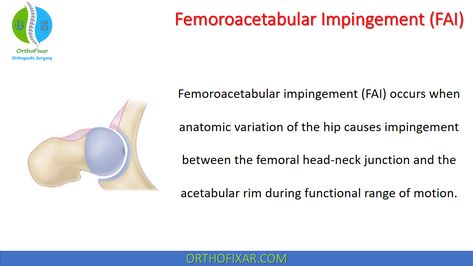 Femoroacetabular Impingement, Tibialis Posterior, Medical Terminology Games, Hip Dislocation, Joints Anatomy, Muscle Anatomy, Orthopedic Surgery, Medical Terminology, Magnetic Resonance