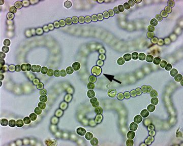 Nostoc-Cyanobacteria Deep Ocean Creatures, Microscopic Organisms, Micro World, Micro Photography, Blue Green Algae, Microscopic Images, Bio Art, Green Algae, Organic Art