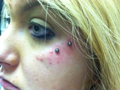 Surface piercing* Surface Piercing, Body Piercings, Piercings, Nose Ring