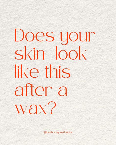 If your skin looks like this after a wax, it’s OK You guys…skin is weird! If you’ve experienced these skin reactions, it’s totally normal and totally something good pre and post wax home care can help to reduce. Some good tips to follow: - limit caffeine & alcohol the day of your appointment - Benadryl or an anti-histamine helps if you’re prone to histamine reactions - Shower on the day of your appointment - Follow all home care recommendations from your esti Hot Honey Esthetics 📍Ma... Wax Appointment, Alter Decor, Hot Honey, Are You Ok, Body Skin, Home Care, Body Skin Care, Your Skin, Honey