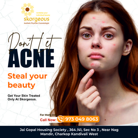 Tired of dealing with pesky acne? Don't let it ruin your self-confidence get your acne treated now! Acne Creative Ads, Skin Creative Ads, Acne Supplements, Medical Sales, Medical Notes, Therapy Exercises, Pimples On Face, Clinic Logo, Beauty Content