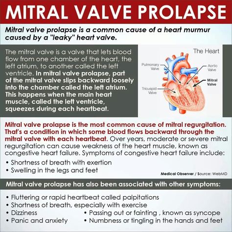 Mitral Valve Prolapse Cath Lab Nursing, Mitral Valve Regurgitation, Nursing School Life, Mitral Valve, Heart Valves, Nursing Mnemonics, Open Heart Surgery, Cardiac Nursing, Critical Care Nursing