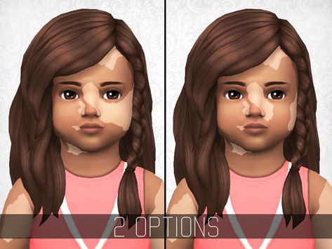 Unique Birthmarks, The Sims 4 Kids, Toddler Cc Sims 4, Sims Baby, Code Roblox, The Sims 4 Skin, Sims 4 Cc Kids Clothing, The Sims 4 Pc, Pelo Sims